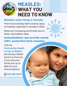 Measles: What you need to know