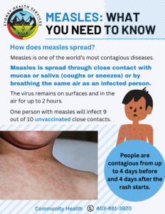 Measles: What you Need to Know